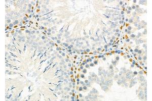 ABIN6262224 and ABIN6266867 at 1/100 staining Rat testis tissue by IHC-P. (HEXIM1 抗体  (C-Term))
