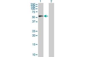 Western Blotting (WB) image for CCNB1 293T Cell Transient Overexpression Lysate(Denatured) (ABIN1331207)