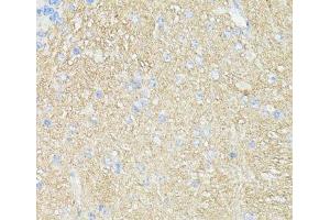 Immunohistochemistry of paraffin-embedded Mouse brain using THY1 Polyclonal Antibody at dilution of 1:100 (40x lens). (CD90 抗体)