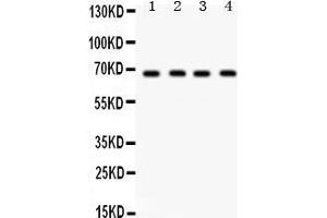 Western Blotting (WB) image for anti-G Protein-Coupled Receptor Kinase 5 (GRK5) (AA 393-429), (C-Term) antibody (ABIN3042434)