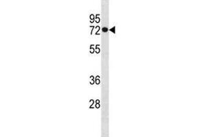 HSPA1L antibody western blot analysis in MDA-MB453 lysate. (HSPA1L 抗体  (AA 576-603))