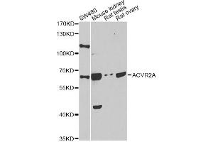Western blot analysis of extracts of various cell lines, using ACVR2A antibody. (ACVR2A 抗体)