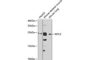 Western blot analysis of extracts of various cell lines, using MYL3 antibody (ABIN6133198, ABIN6144249, ABIN6144250 and ABIN6222363) at 1:1000 dilution. (MYL3/CMLC1 抗体  (AA 1-195))