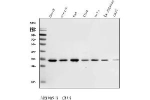 Western blot analysis of Carbonic Anhydrase 13/CA13 using anti-Carbonic Anhydrase 13/CA13 antibody (ABIN7603164).