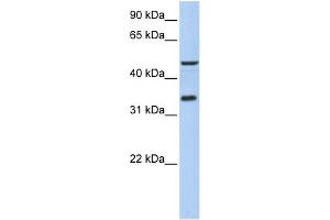 Western Blotting (WB) image for anti-Interaction Protein For Cytohesin Exchange Factors 1 (IPCEF1) (Middle Region) antibody (ABIN2782549)