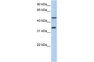 WB Suggested Anti-PIP3-E Antibody Titration:  0. (ICEF1 抗体  (Middle Region))