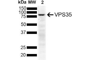 Western Blot analysis of Human SH-SY5Y showing detection of VPS35 protein using Mouse Anti-VPS35 Monoclonal Antibody, Clone 11H10 (ABIN6933004). (VPS35 抗体)