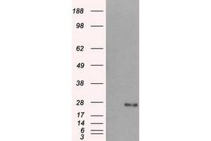 Western Blotting (WB) image for anti-Dicarbonyl/L-Xylulose Reductase (DCXR) antibody (ABIN1497784) (DCXR 抗体)