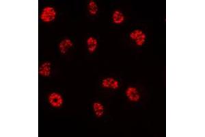 Immunofluorescent analysis of PE2 staining in HeLa cells. (ERF 抗体  (C-Term))