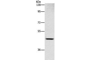 Western Blot analysis of Human placenta tissue using CD327 Polyclonal Antibody at dilution of 1:1000 (SIGLEC6 抗体)