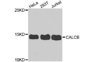 Western blot analysis of extract of various cells, using CALCB antibody.