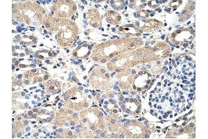 EXOSC7 antibody was used for immunohistochemistry at a concentration of 4-8 ug/ml to stain Epithelial cells of renal tubule (arrows) in Human Kidney. (EXOSC7 抗体  (N-Term))