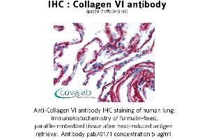 Image no. 1 for anti-Collagen, Type VI (COL6) antibody (ABIN1733229) (COL6 抗体)