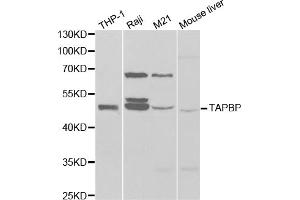 Western blot analysis of extracts of various cell lines, using TAPBP antibody (ABIN6293644) at 1:1000 dilution.