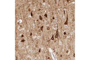 Immunohistochemical staining (Formalin-fixed paraffin-embedded sections) of human cerebral cortex with TNK1 polyclonal antibody  shows strong cytoplasmic positivity in neuronal cells at 1:20-1:50 dilution. (TNK1 抗体)