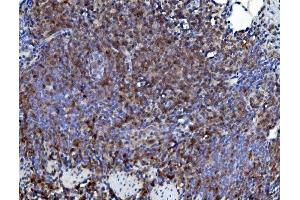IHC analysis of CD226 using anti-CD226 antibody (ABIN7601264).