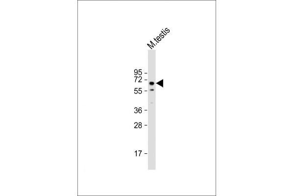 TOR1AIP1 抗体  (AA 42-76)