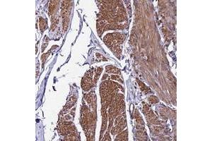 Immunohistochemical staining of human smooth muscle with YEATS2 polyclonal antibody  shows distinct cytoplasmic positivity. (YEATS2 抗体)