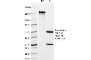 SDS-PAGE (SDS) image for anti-Cytokeratin-2P (KRT76) antibody (ABIN6941415)
