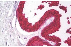 Image no. 2 for anti-Prostate Specific Antigen (PSA) antibody (ABIN1502668) (Prostate Specific Antigen 抗体)