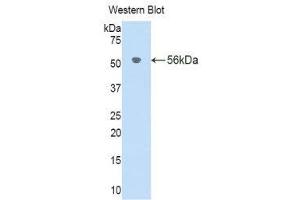 Western Blotting (WB) image for anti-Interleukin 18 Binding Protein (IL18BP) (AA 29-193) antibody (ABIN1176682) (IL18BP 抗体  (AA 29-193))