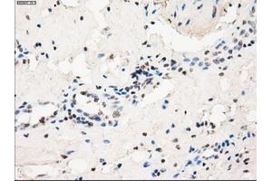 Immunohistochemical staining of paraffin-embedded pancreas tissue using anti-FCGR2A mouse monoclonal antibody. (FCGR2A 抗体)