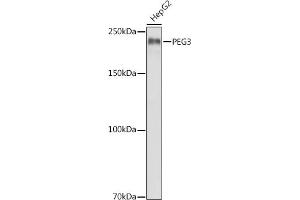 Western blot analysis of extracts of HepG2 cells, using PEG3 antibody (ABIN6128527, ABIN6145434, ABIN6145435 and ABIN6216398) at 1:1000 dilution. (PEG3 抗体  (AA 1-300))