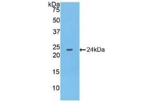Detection of Recombinant IL10, Human using Polyclonal Antibody to Interleukin 10 (IL10) (IL-10 抗体  (AA 1-178))