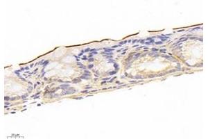 Immunohistochemistry analysis of paraffin-embedded mouse colon using,NHE-3 (ABIN7075685) at dilution of 1: 1200 (SLC9A3 抗体)