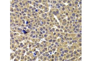 Immunohistochemistry of paraffin-embedded Mouse lung cancer using ARID3A Polyclonal Antibody at dilution of 1:100 (40x lens). (ARID3A 抗体)