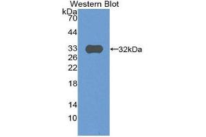 Western Blotting (WB) image for anti-Complement Component C9 (C9) (AA 22-265) antibody (ABIN1866979) (C9 抗体  (AA 22-265))