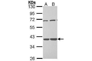 WB Image Sample (30 ug of whole cell lysate) A: H1299 B: Hela 10% SDS PAGE antibody diluted at 1:1000 (TSTA3 抗体  (C-Term))