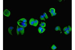 Immunofluorescent analysis of MCF-7 cells using ABIN7143935 at dilution of 1:100 and Alexa Fluor 488-congugated AffiniPure Goat Anti-Rabbit IgG(H+L) (NAPA 抗体  (AA 1-295))