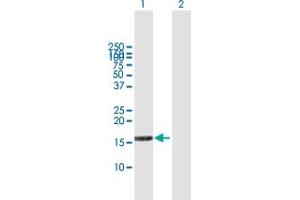 Western Blot analysis of DUSP22 expression in transfected 293T cell line by DUSP22 MaxPab polyclonal antibody. (DUSP22 抗体  (AA 1-184))
