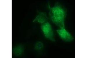 Image no. 2 for anti-Musashi Homolog 1 (Drosophila) (MSI1) antibody (ABIN1499574) (MSI1 抗体)