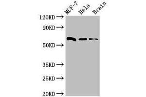 Western blot analysis of MCF-7 whole cell lysate, HeLa whole cell lysate and Mouse brain tissue, using SGO1 antibody (3 μg/ml) as the primary antibody and Goat anti-Rabbit polyclonal antibody (1/50000 dilution) as the secondary antibody. (Shugoshin 抗体  (AA 260-439))