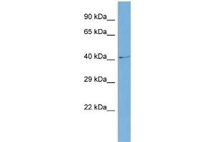 Host:  Rabbit  Target Name:  SLC6A5  Sample Type:  COLO205 Whole cell lysates  Antibody Dilution:  1. (SLC6A5 抗体  (N-Term))