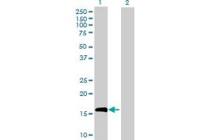 Western Blot analysis of IL10 expression in transfected 293T cell line by IL10 MaxPab polyclonal antibody. (IL-10 抗体  (AA 1-178))