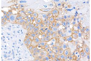 Immunohistochemistry (IHC) image for anti-CD44 (CD44) (AA 692-742) antibody (ABIN7453578) (CD44 抗体  (AA 692-742))