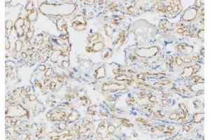 IHC analysis of VEGF Receptor 3 using anti-VEGF Receptor 3 antibody (ABIN5693136).