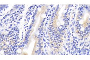 Detection of MUC5B in Human Small intestine Tissue using Polyclonal Antibody to Mucin 5 Subtype B (MUC5B)