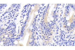 Detection of MUC5B in Human Small intestine Tissue using Polyclonal Antibody to Mucin 5 Subtype B (MUC5B) (MUC5B 抗体  (AA 5366-5444))