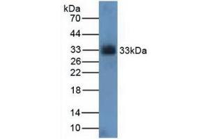 Figure. (CDK4 抗体  (AA 6-295))