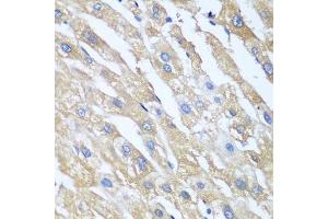 Immunohistochemistry of paraffin-embedded human liver using PPP4R1 antibody. (PPP4R1 抗体  (AA 324-647))
