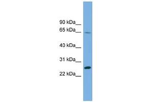 WB Suggested Anti-DHFRL1 Antibody Titration: 0. (DHFRL1 抗体  (Middle Region))
