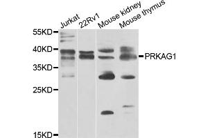 Western blot analysis of extracts of various cell lines, using PRKAG1 antibody. (PRKAG1 抗体)