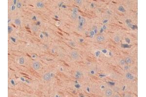 DAB staining on IHC-P; Samples: Rat Cerebrum Tissue (MEPE 抗体  (AA 28-224))