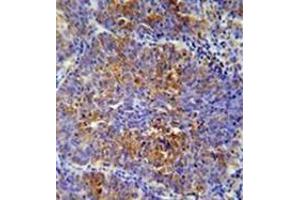 Immunohistochemistry (Paraffin-embedded Sections) (IHC (p)) image for anti-Activating Transcription Factor 7 Interacting Protein 2 (ATF7IP2) (AA 325-355), (Middle Region) antibody (ABIN953344)