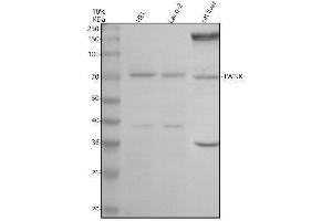 Western blot analysis of Twinkle/TWNK using anti-Twinkle/TWNK antibody (ABIN7825314).