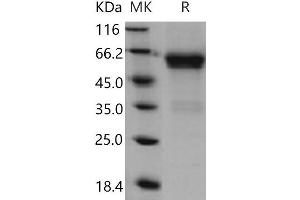 Western Blotting (WB) image for CD27 Molecule (CD27) (Active) protein (His tag,Fc Tag) (ABIN7194768) (CD27 Protein (His tag,Fc Tag))
